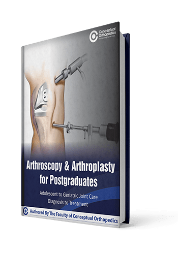 Arthroscopy & Arthroplasty For PG